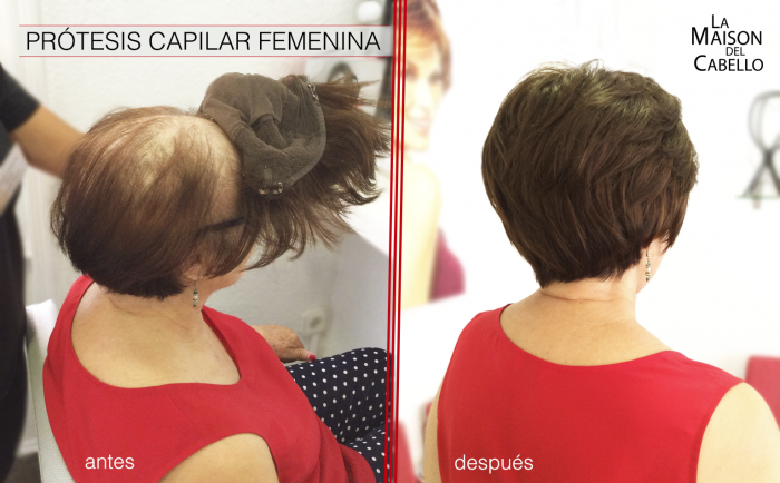 cambio de look prótesis capilar femenina 