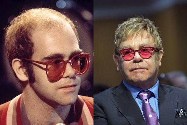 implante elton john