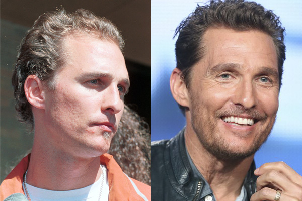 Matthew McConaughey calvicie