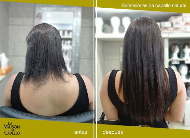 extensiones antes y después